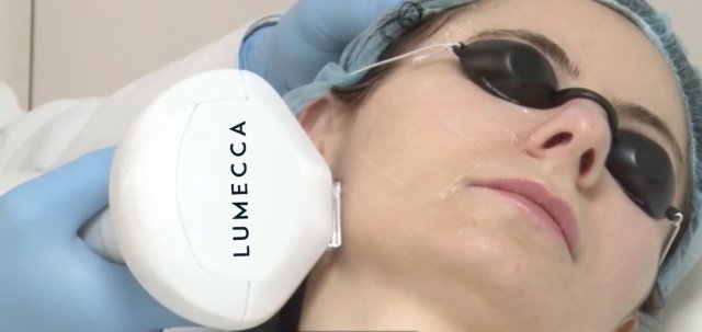 Световая магия: Преображение кожи с Lumecca